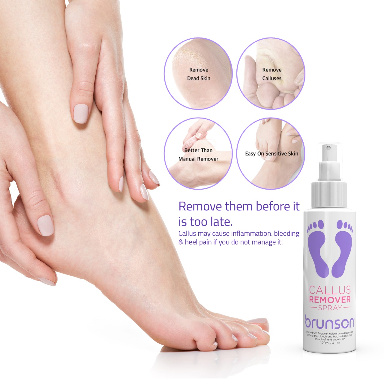 Foot Callus Softener, Callus Remover Spray Moisturizing Foot Care Gel Dead  Skin Horniness Removal BCR120