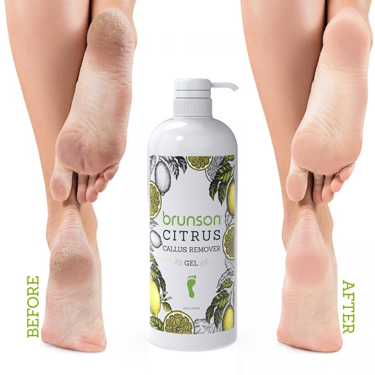 Citrus Callus Remover Gel Best Callus Remover Brunson