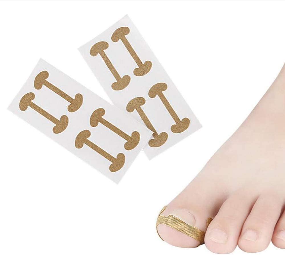 Ingrown Toenail Corrector Stickers BNSS-Brunson