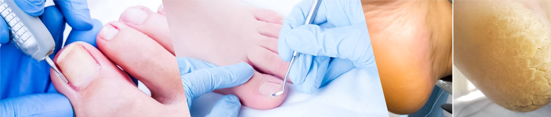 Advanced-Podiatry-Training-Course-3