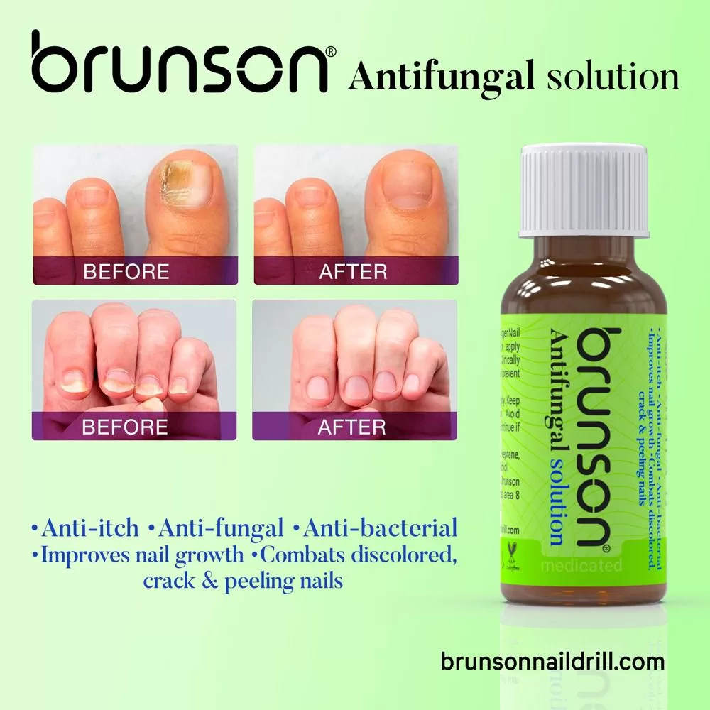 Nail-anti-fungal-solution-3 fungus treatment for nails